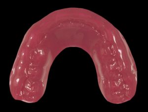 , Mouthguards
