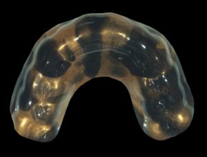 , Mouthguards